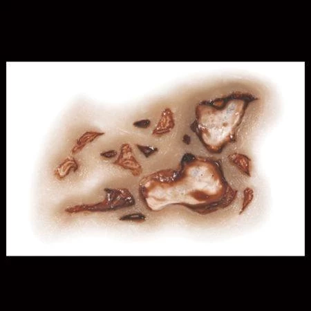 Tinsley Transfers Zombie Jawbone Scar Halloween Horror Makeup 3D FX Transfers Buy Costumes 4 Tinsley Transfers Zombie Jawbone Scar Halloween Horror Makeup 3D FX Transfers Buy Costumes