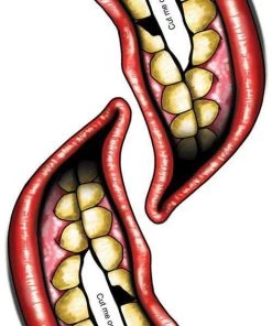 Tinsley Transfers Womens Chipped Big Mouth Temporary Tattoos